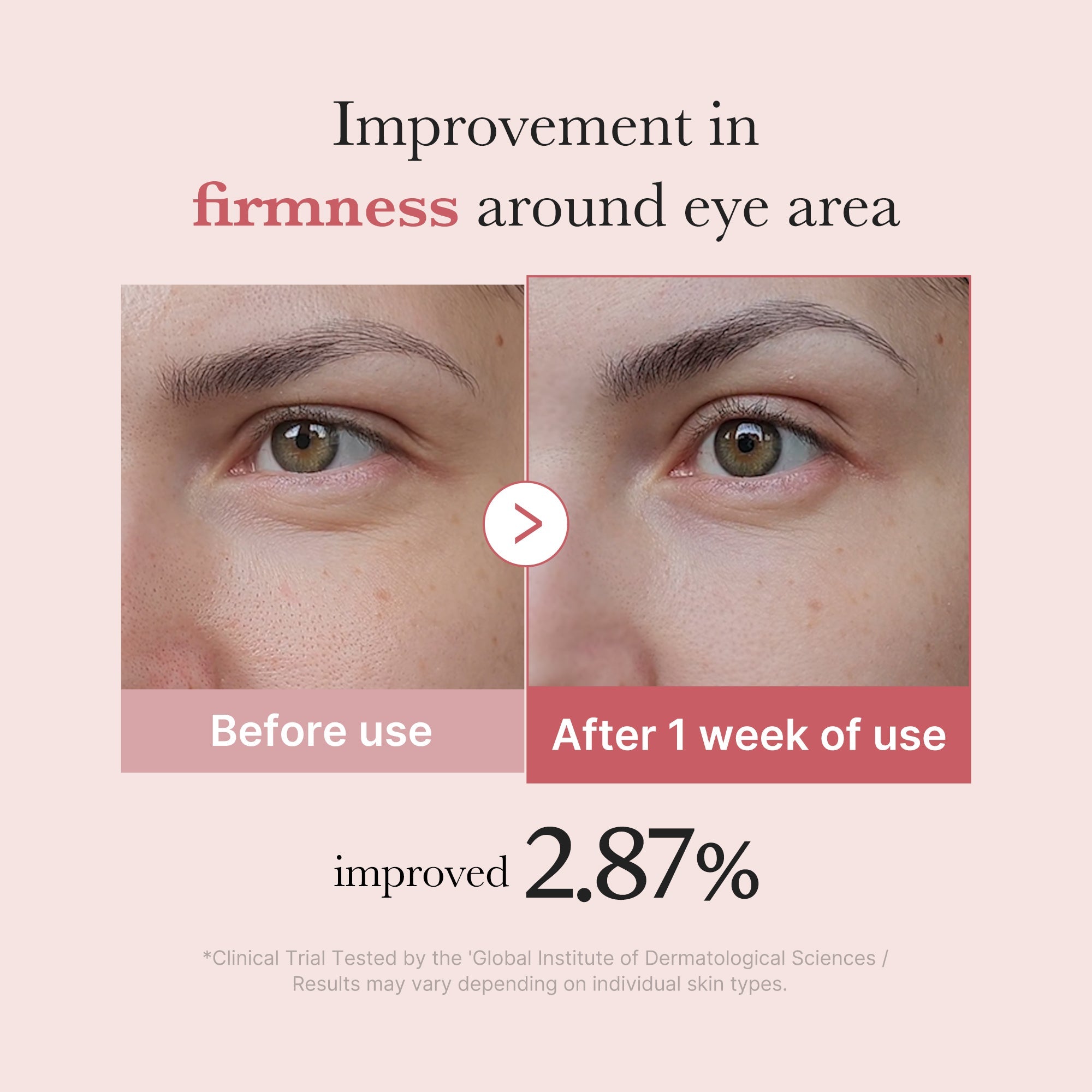 PDRN Pink Peptide Eye Cream - SKINZA