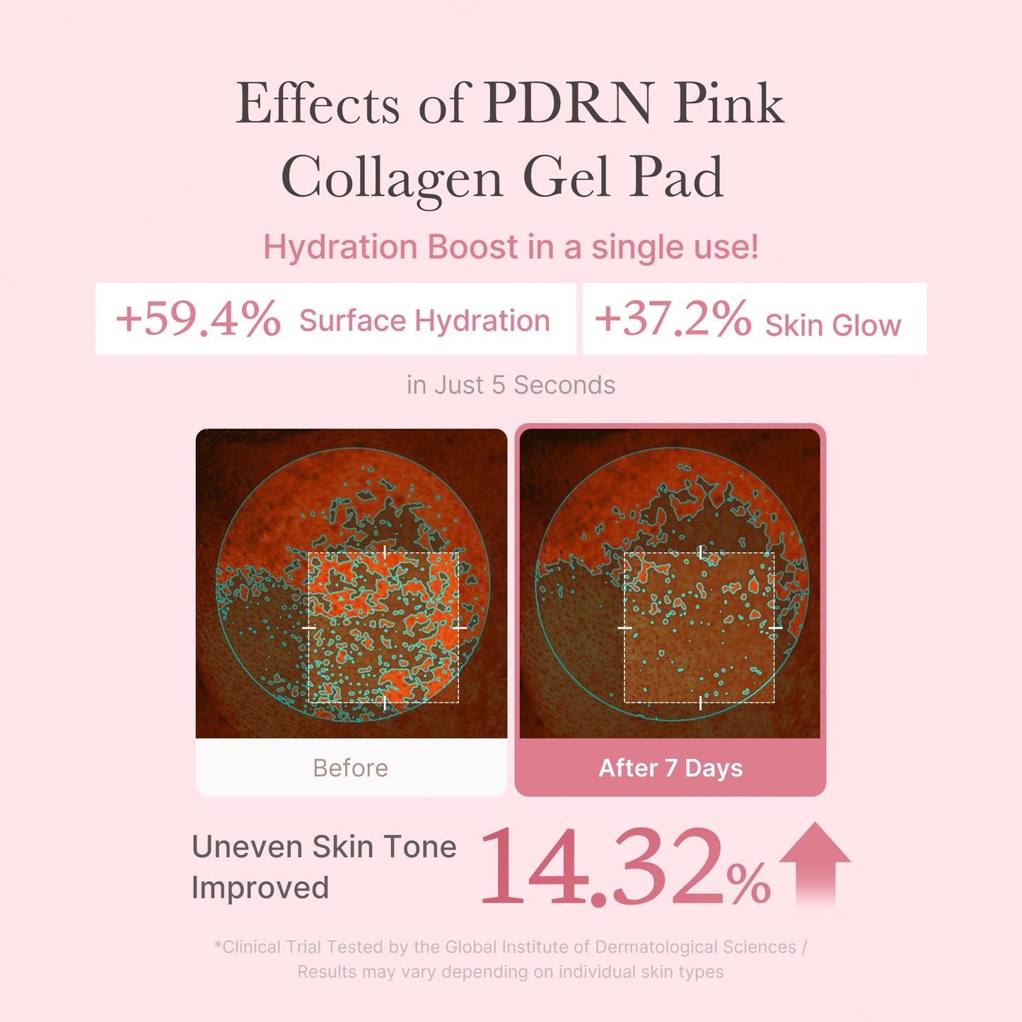 PDRN Pink Collagen Gel Toner Pad - SKINZA