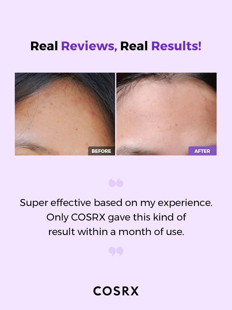 AHA/BHA Clarifying Treatment Toner - SKINZA