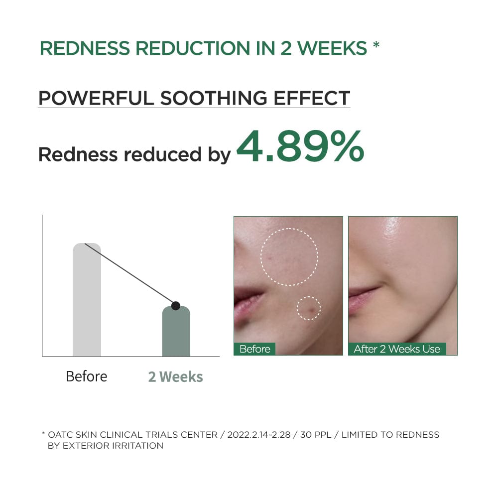 Anua US Heartleaf 80% Moisture Soothing Ampoule in a 30ml bottle, featuring clear glass packaging with a white pump top.