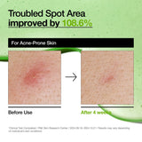 Anua Azelaic Acid 10 Hyaluron Redness Soothing Serum ampoule with clear liquid and dropper for skincare.