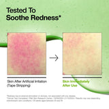 Anua Azelaic Acid 10 Hyaluron Redness Soothing Serum ampoule with clear liquid in a glass vial, designed for calming skin.