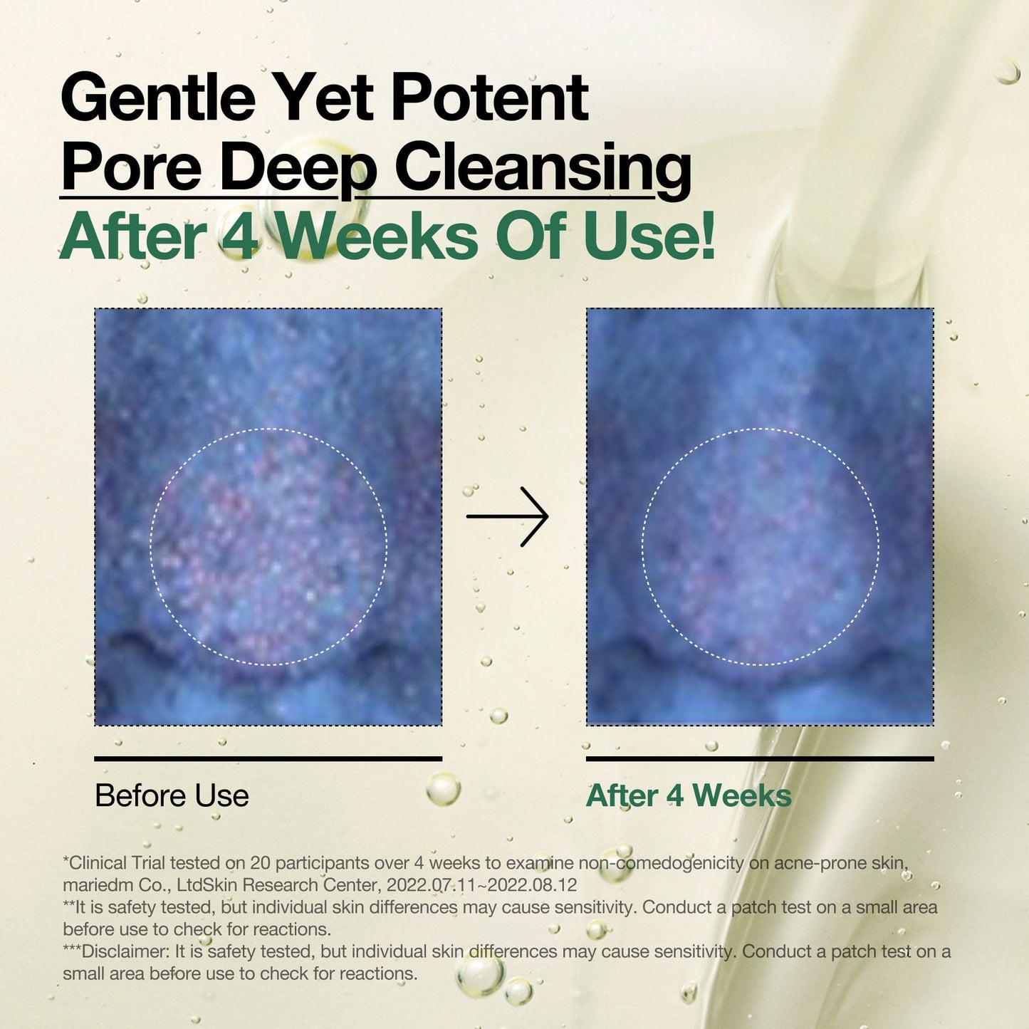 Anua US Heartleaf Pore Control Cleansing Oil in 200ml bottle, designed to cleanse pores and control oil production.